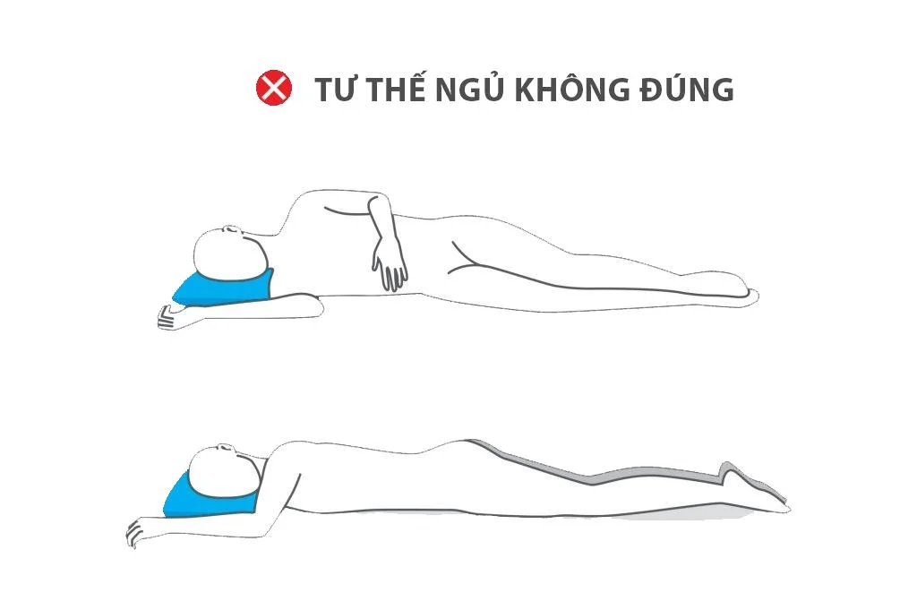 Tư thế ngủ không đúng